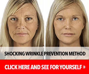 Collagen Select collagen supplement jar promoting skin, hair, nail, and joint support.